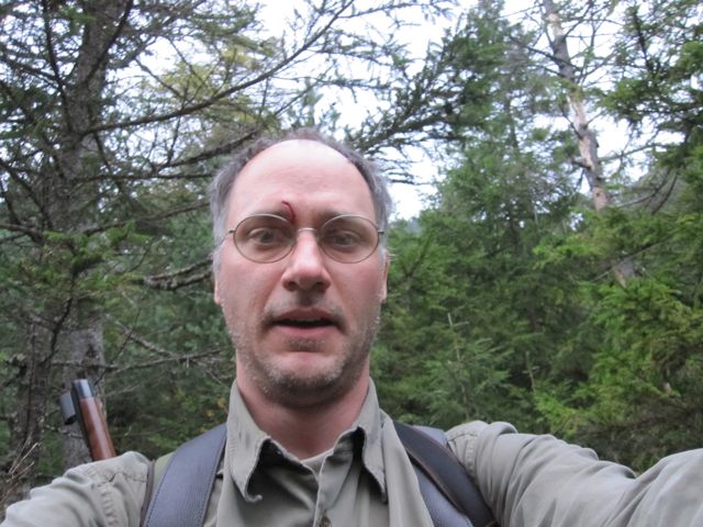 Me after getting the deer.  Unfortunately the recoil of the 9,3x62 (substantial) is too much in a confined space.  My head got caught against the roof of the blind as my shoulder continued back, and the scope kissed my eyebrow, which is bleeding slightly in this pic.  Note 5 days of beard.